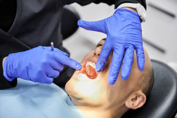 Best Broken or Chipped Tooth Repair in Yreka, CA